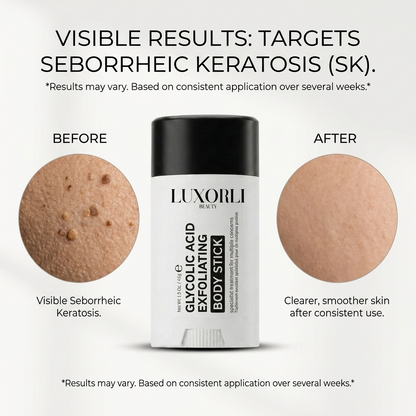 Luxorli Glycolic Acid Body Stick
